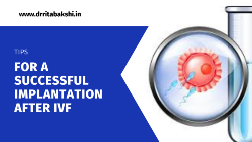 Tips For a successful implantation after IVF Treatment