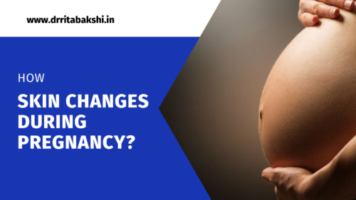 How skin changes during Pregnancy?