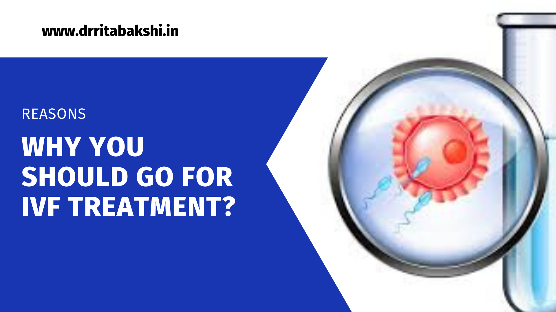 Reasons you should go for IVF Treatment in 2022