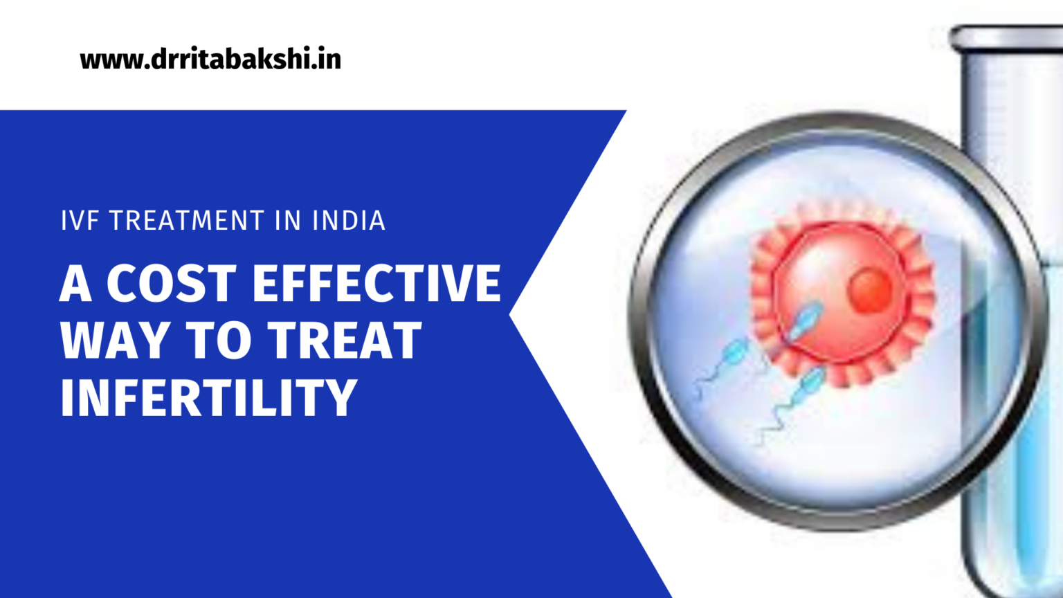 IVF Treatment in India: A Cost Effective Way to Treat Infertility