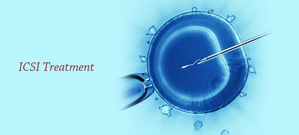 Need to Know about the Role of ICSI in IVF Treatment - Dr Rita Bakshi