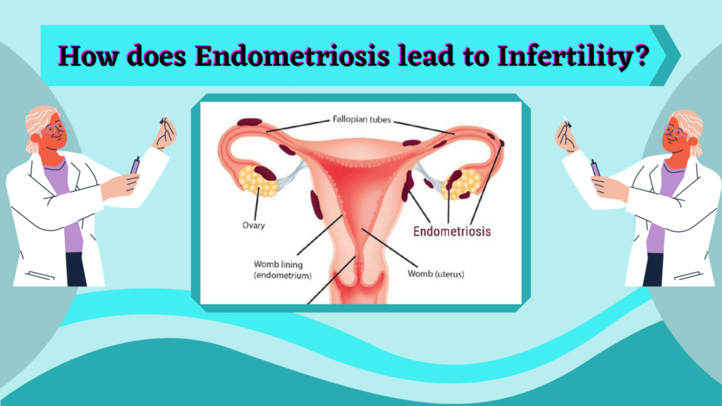 How does Endometriosis lead to Infertility? - Dr Rita Bakshi