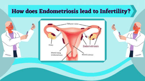 How does Endometriosis lead to Infertility? - Dr Rita Bakshi