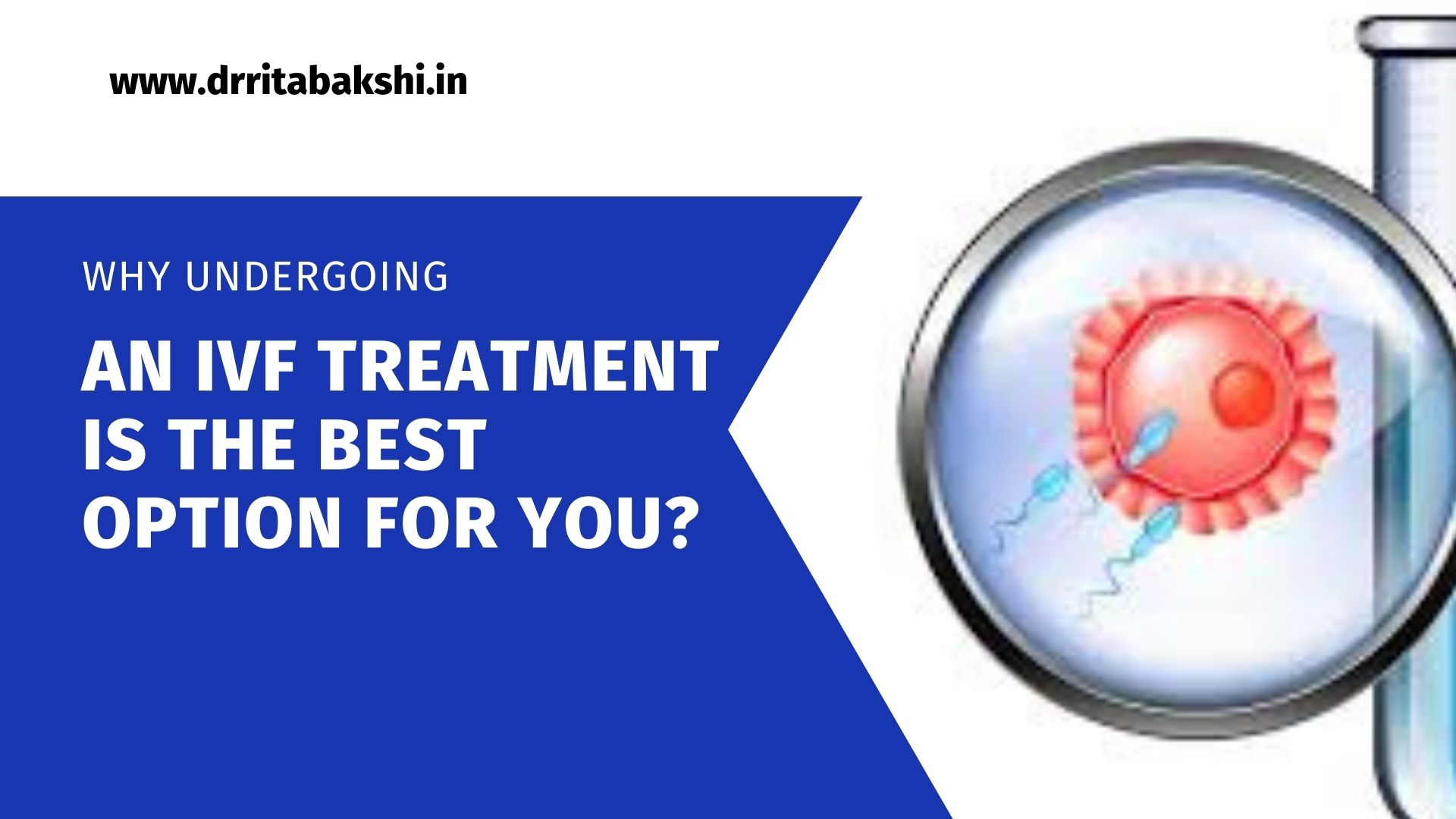 Why undergoing an IVF treatment is the best option for you?