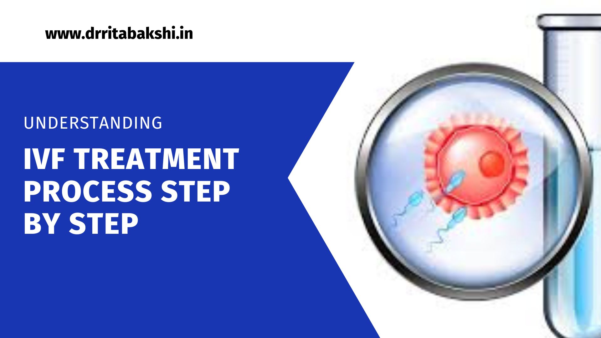 IVF Treatment Process - Step-by-Step