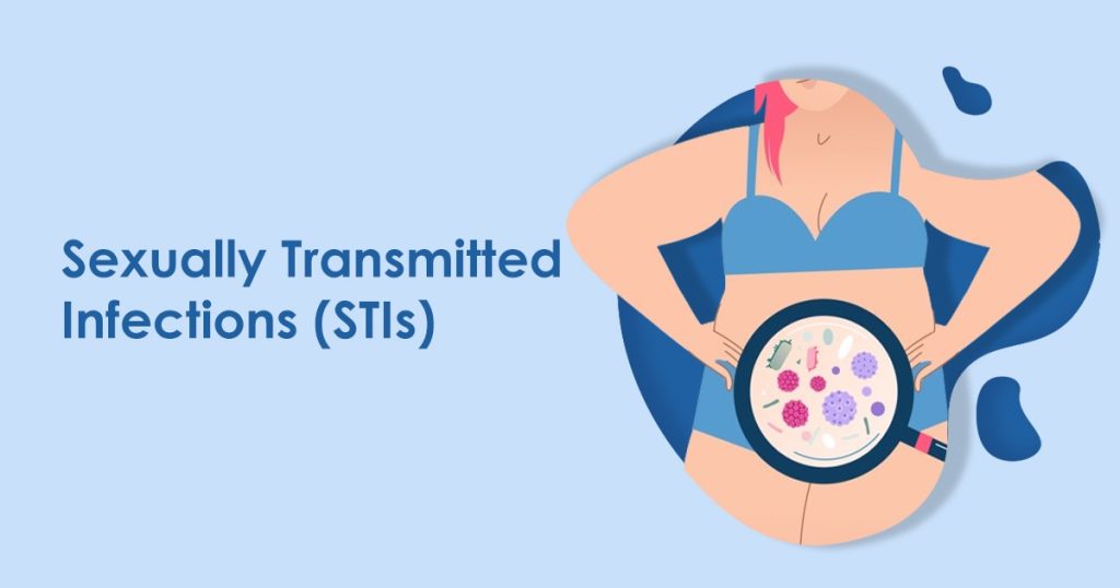 Sexually Transmitted Infections