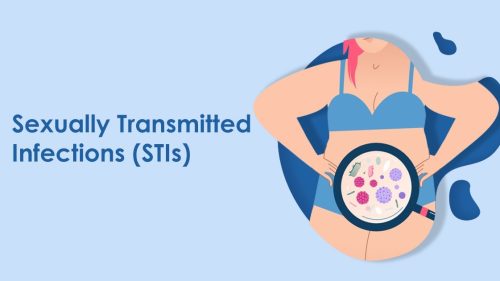 Sexually Transmitted Infections