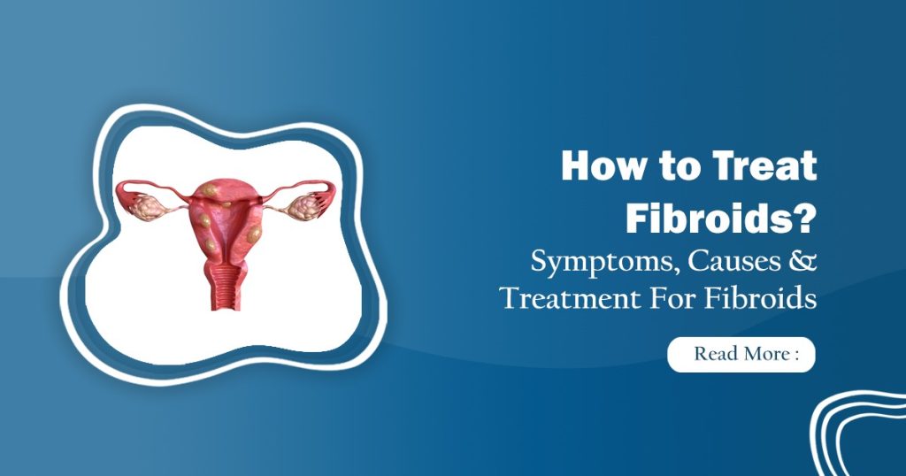 fibroid treatment