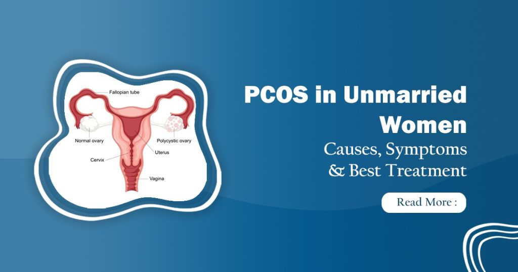 Best PCOS treatments for unmarried Women, in Delhi 2025