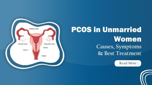 Best PCOS treatments for unmarried Women, in Delhi 2025