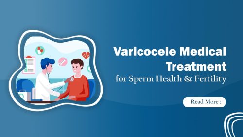 Varicocele medical treatment