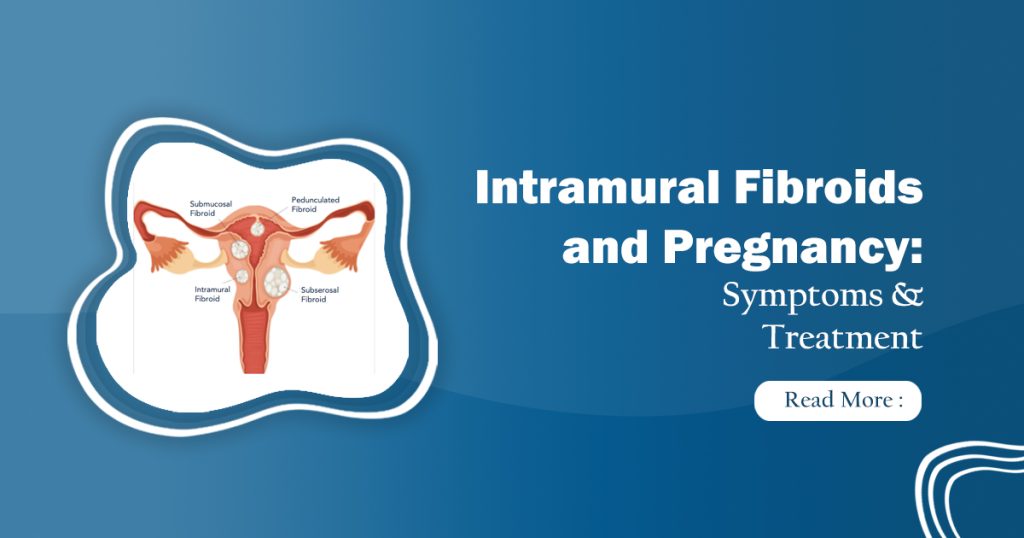 Intramural Fibroids and Pregnancy