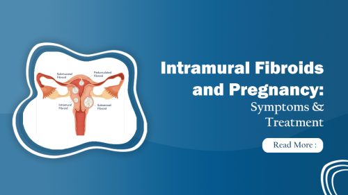 Intramural Fibroids and Pregnancy