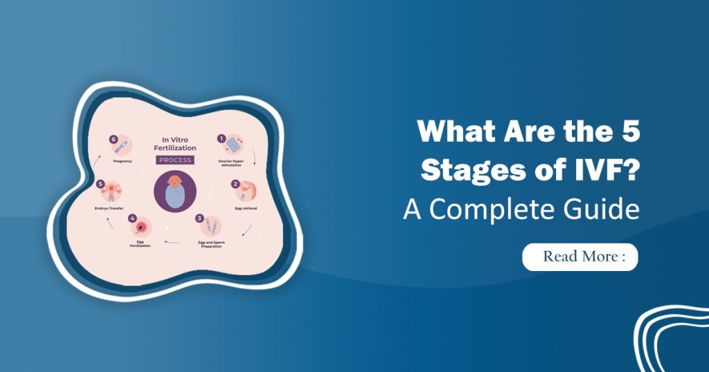 5 Stages of IVF