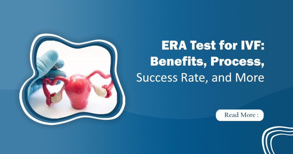 ERA Test for IVF