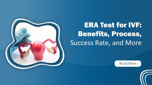 ERA Test for IVF