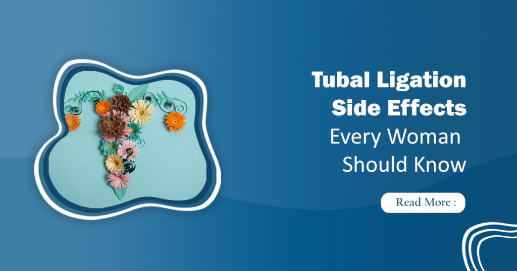 Tubal Ligation