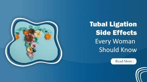 Tubal Ligation