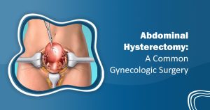 Abdominal Hysterectomy