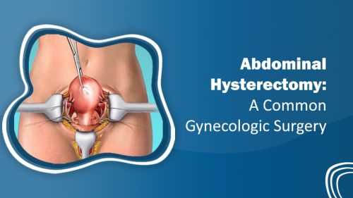 Abdominal Hysterectomy