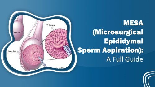 Microsurgical Epididymal Sperm Aspiration (MESA)