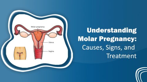 Molar Pregnancy