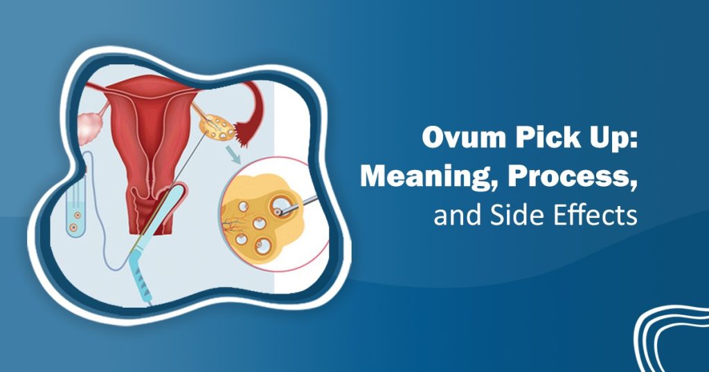 Ovum Pick Up