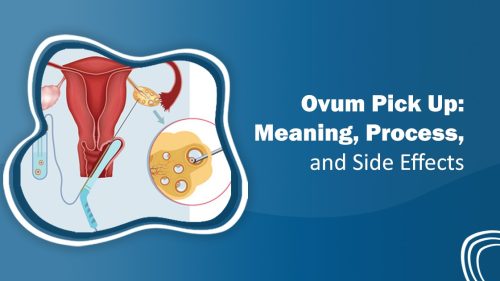 Ovum Pick Up