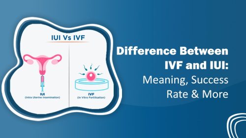 Difference Between IVF and IUI