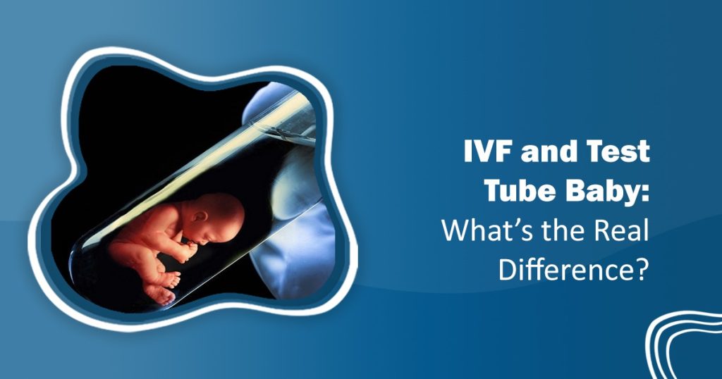 IVF and Test Tube Baby