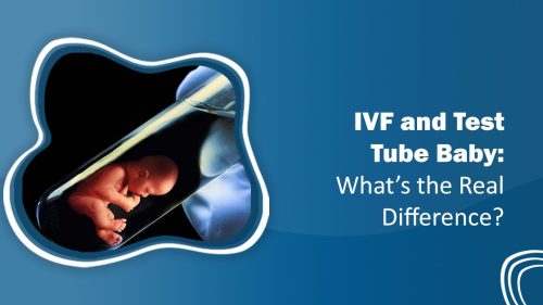IVF and Test Tube Baby