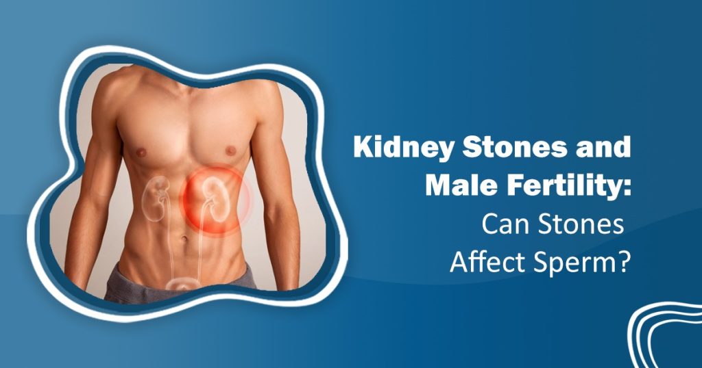 Kidney Stones and Male Fertility
