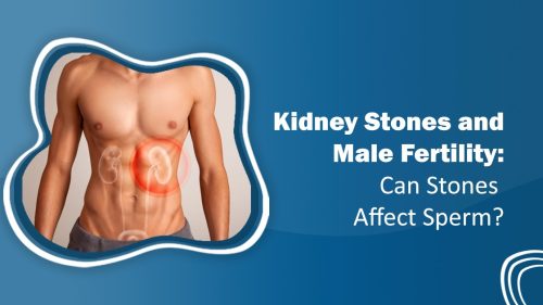 Kidney Stones and Male Fertility