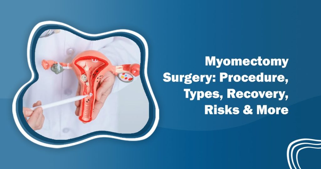 Myomectomy surgery