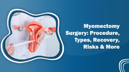 Myomectomy surgery