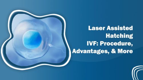 Laser-Assisted Hatching IVF