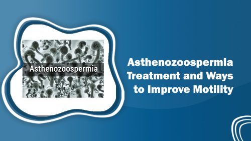 Asthenozoospermia Treatments