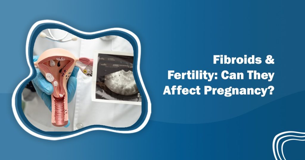 Fibroids and Fertility