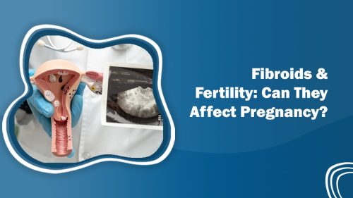 Fibroids and Fertility