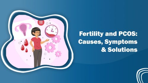 PCOS and fertility